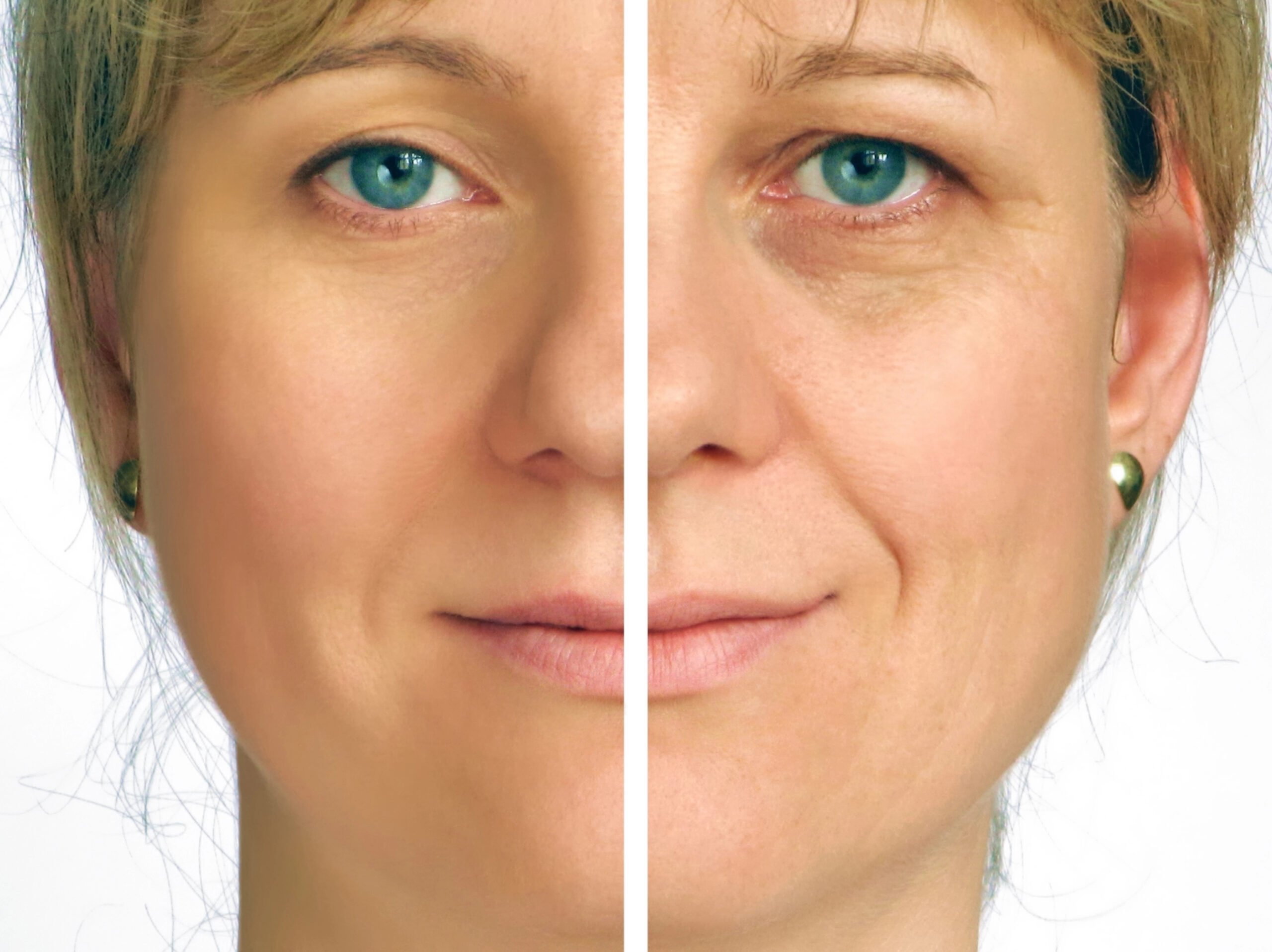 peak rejuvenation - before and after (3)